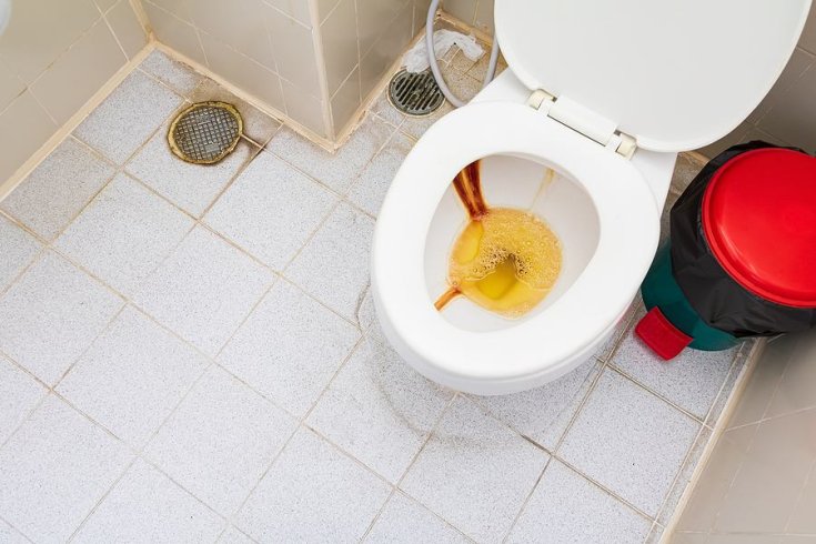 How to Prevent Rust Stains in Toilet Bowls